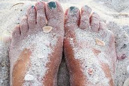 Comment Soigner Ses Pieds Sec?
