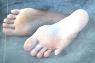 Comment Soigner Les Pieds Qui Puent?