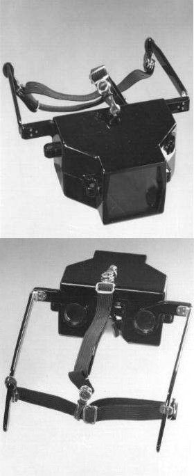 Le myopter pour corriger la myopie